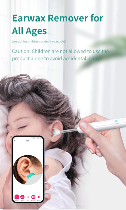 Smart Visual Ear Cleaner with Camera 1296P